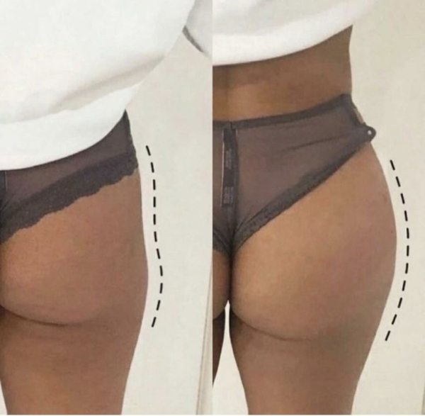 Hips & Butt Enhancement Gummies - 40 Candies - Image 2